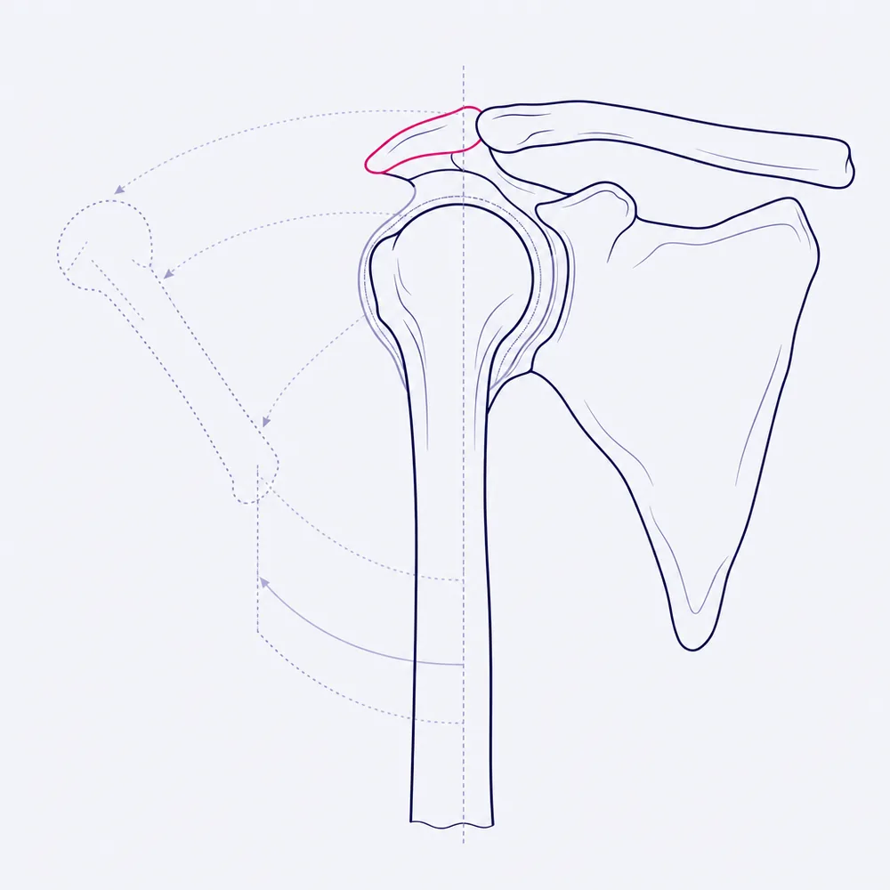 A shoulder joint from the front: the socket, the collarbone and the head of the arm bone, with the arm drawn again at two raised positions